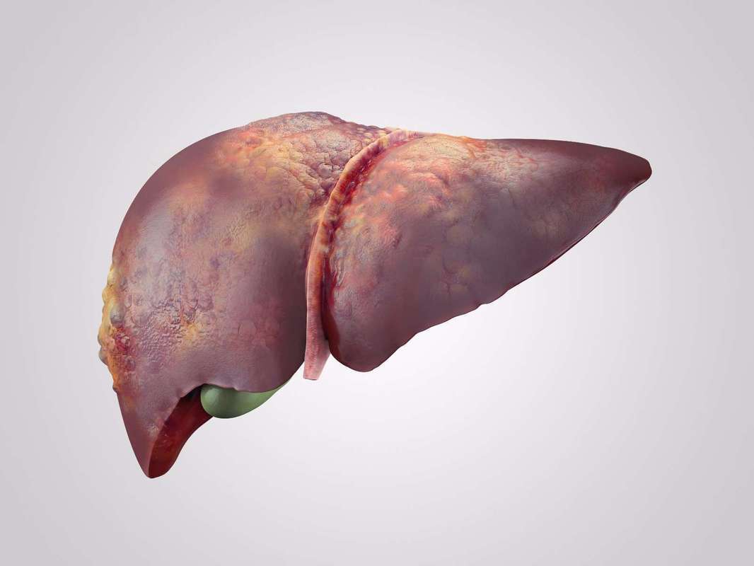 维生素b3食物_维生素B3慢阻肺治疗_慢阻肺维生素B3研究